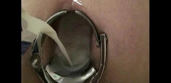  Ass stretched by speculum and filled with milk